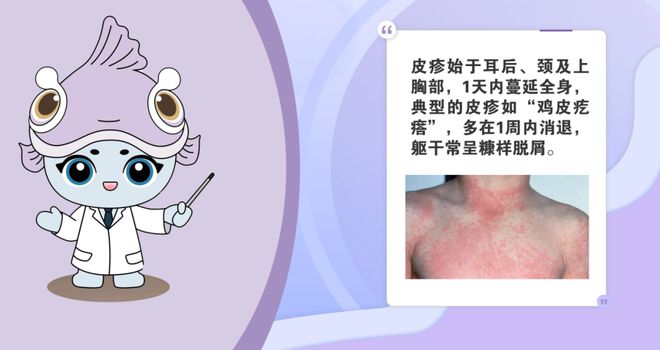 這個病尚無疫苗預防出現(xiàn)發(fā)熱、咽痛、皮疹等癥狀馬上去醫(yī)院→(圖2)